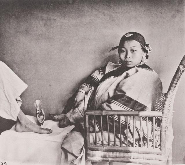 实拍三寸金莲裹脚缠足全过程,三寸金莲的缠足过程