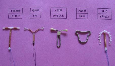 宫内节育器和节育环有什么区别,宫内节育器避孕环