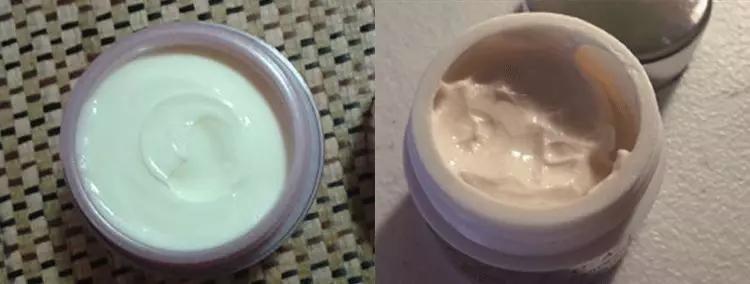 脂肪粒怎么用针挑出的,脂肪粒多久可以用针挑出来