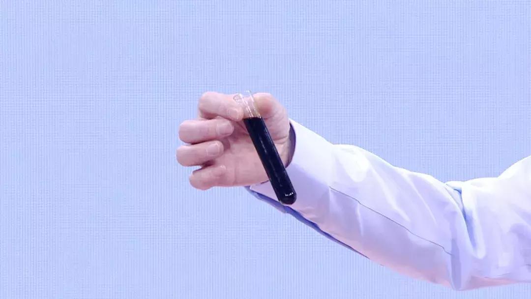 抽血颜色发黑，血液太粘稠了？这3种致病血液，可能都是吃出来的