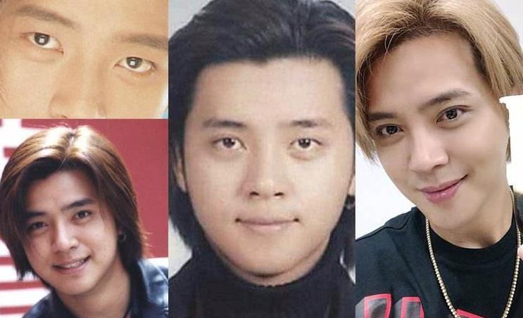 男生小眼睛割双眼皮前后对比,男生割双眼皮多久恢复自然