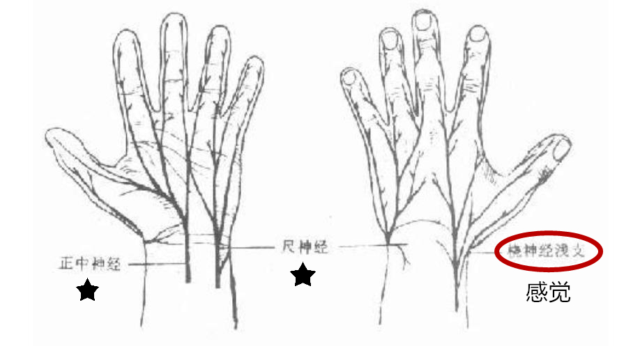 鎵嬮儴涓灑绁炵粡鍙楁崯浼氬紩璧锋墜楹诲悧,鎵嬮儴绁炵粡鍙楁崯鎵嬮夯鎬庝箞鍥炰簨
