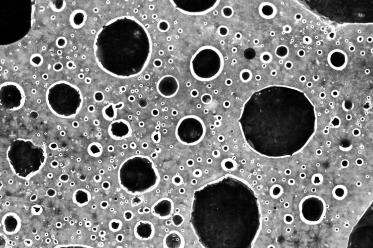 白头发怎么变黑民间治疗白发偏方,中医对少年白发的治疗方法