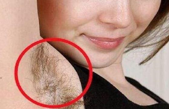 女性腋毛旺盛究竟是好事还是坏事,女性腋毛多会影响备孕吗