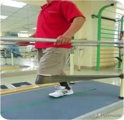 简单的截肢方法,截肢物理治疗