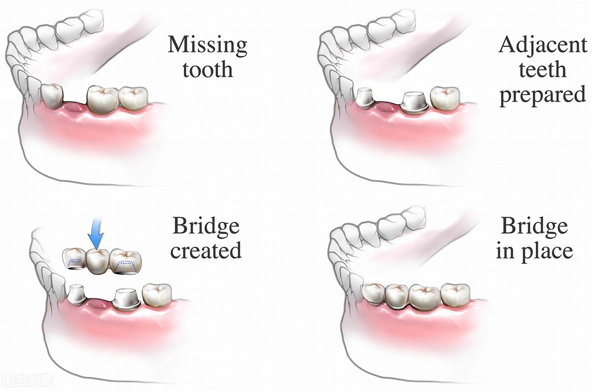 商业模式服务案例,商业模式绩效模式盈利模式