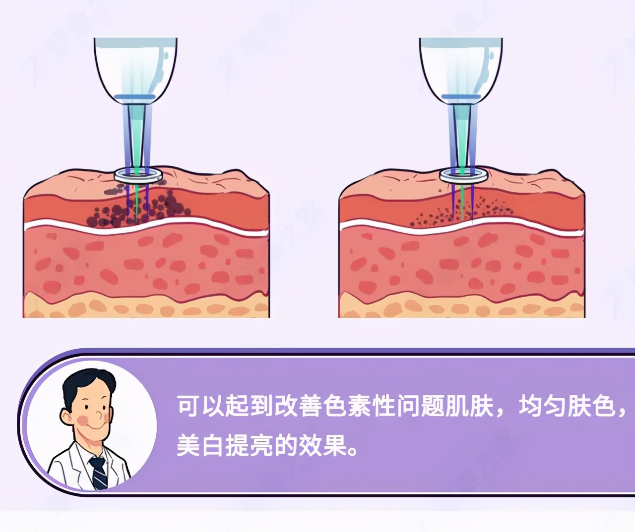 祛斑去黄护肤品怎么买,祛斑去医院皮肤科怎么样