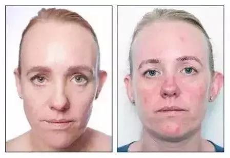 超人气卸妆,超级平价卸妆产品