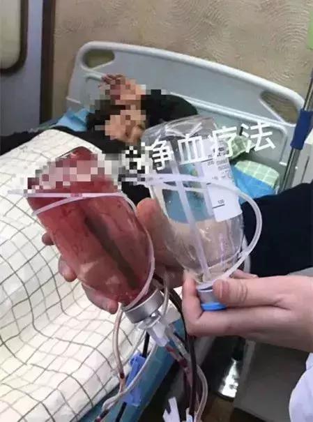 血液净化排毒,血液净化美容有作用吗