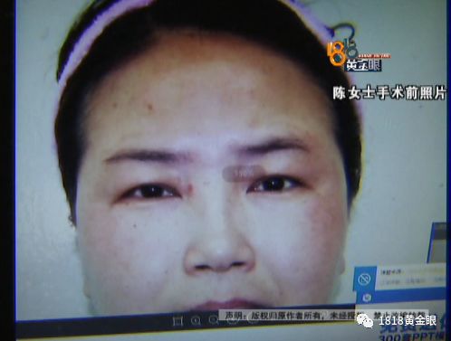 感觉自己不如以前漂亮了,感觉自己不如以前好看