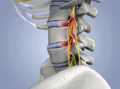 颈椎按摩专属按摩师,送你一套中医推拿疗法