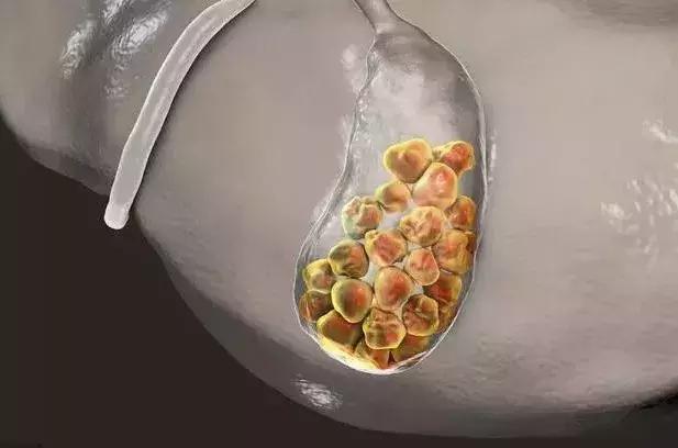 超声专家是做b超还是看结果,超声影像检查专家