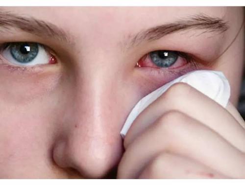 宝宝结膜炎如何照顾,宝宝结膜炎怎么快速治愈