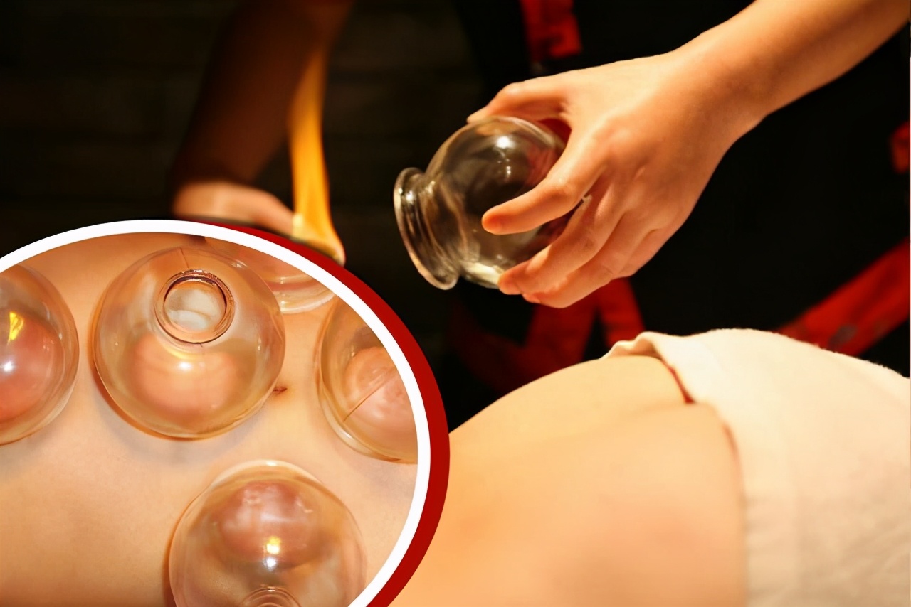 肩周炎颈椎病怎样拔火罐,拔火罐可以治疗颈椎病