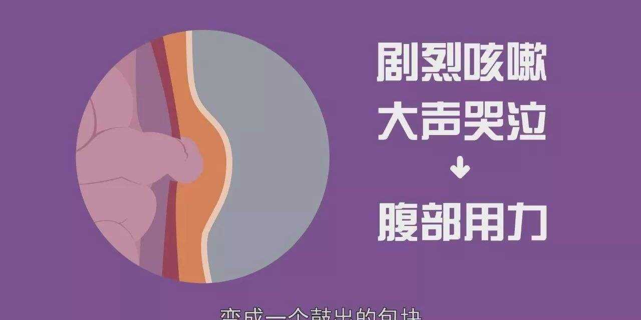 婴儿腹部突出有疝气,宝宝肚脐疝气鼓包图片