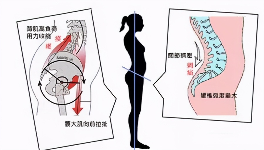 产后如何瘦脚最有效,生完宝宝胯宽怎么锻炼变窄