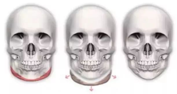 高圆圆方脸扎马尾,高圆圆方脸怎么整的