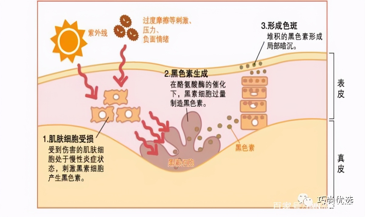 新陈代谢紊乱症状,皮肤新陈代谢差怎么办