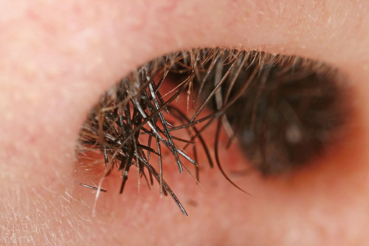 鼻毛太长拔下来,鼻毛太长直接拔掉会怎样