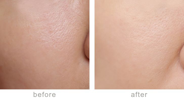 最近最火的粉底液,比较推荐的几款粉底液