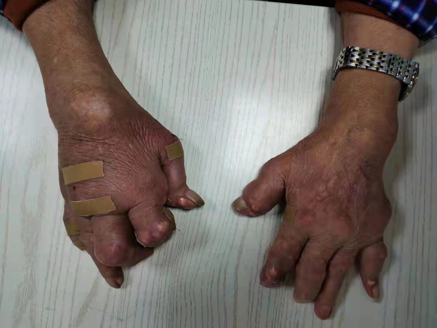 中华医学会风湿分会会员陈乐天名医工作室在贵阳强直医院揭牌成立