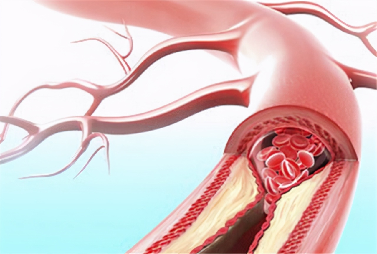 高血压的老年人补充哪种叶酸片好,高血压补充叶酸用哪种叶酸好