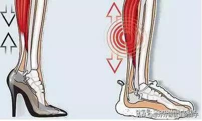 一个方法解决足跟痛,什么方法缓解足跟痛