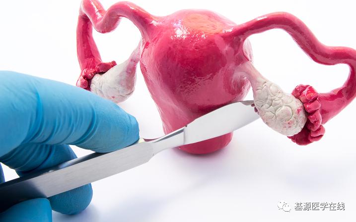 女士避孕方式有几种哪种最好用,女性比较可靠的避孕方式