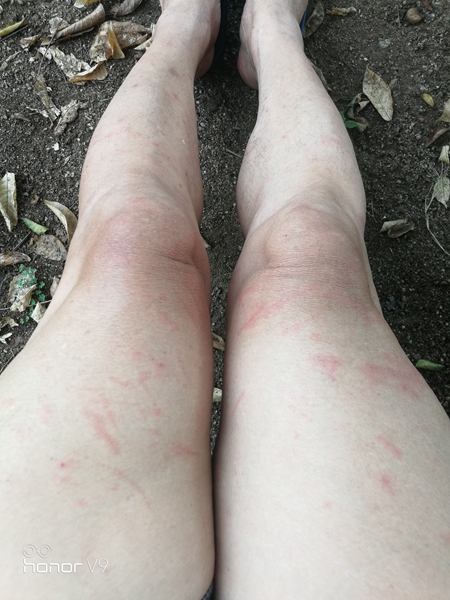 一双被水草割伤的老腿