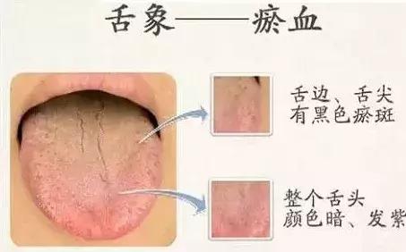 观舌识病22种舌诊图解大全,舌诊看舌头视频