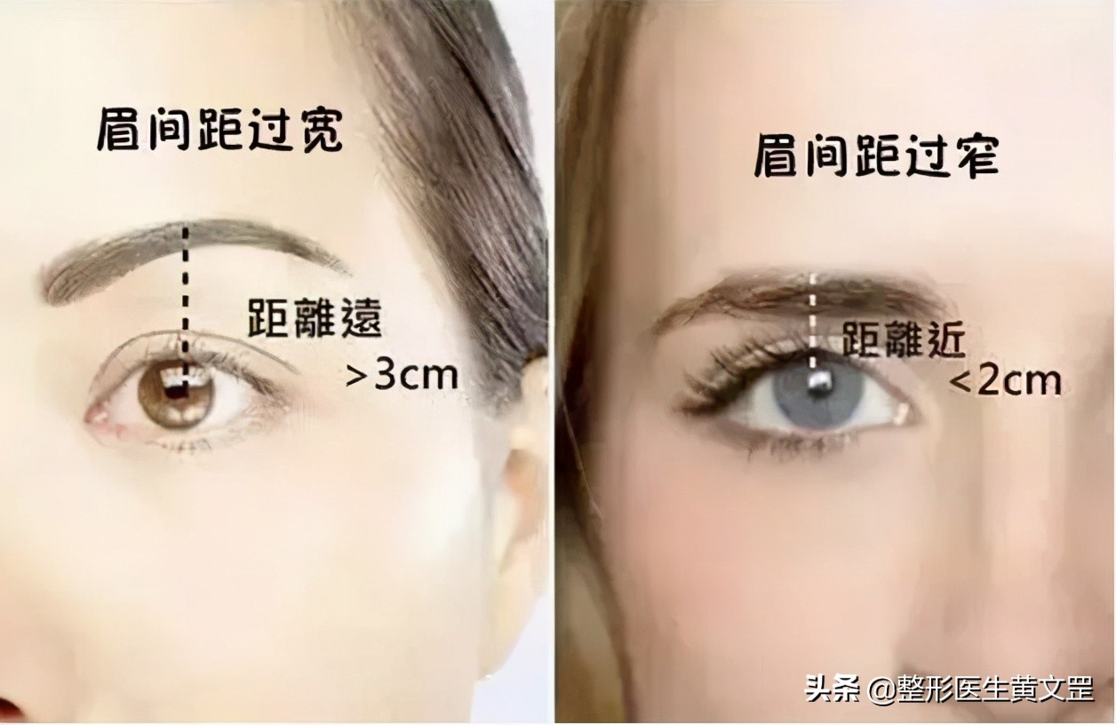 王世勇什么样的眼睛是美的,什么样子的眼睛才好看