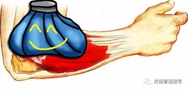 网球肘能自我恢复吗,网球肘病因的解剖学研究