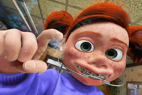 9块9隐形牙套,在家自制透明牙套