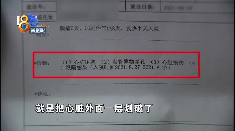 金属丝划破孩子心脏，家长推测“钢丝刷”