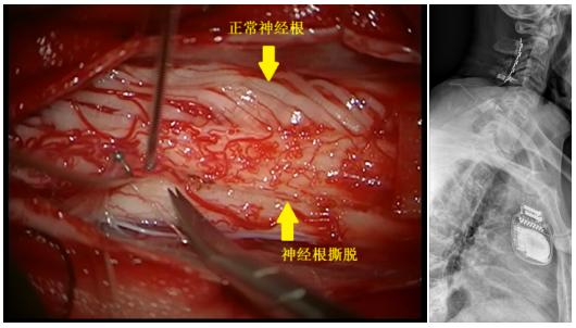 宣医科普|明明截肢了，为什么还感觉疼？