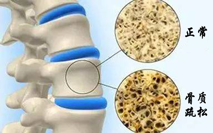 缺钙抽筋和着凉抽筋有什么区别,小腿抽筋脚趾也抽筋是缺钙吗