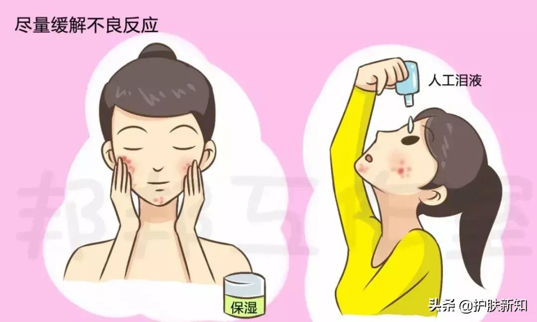 痘疮怎么消除,痘疮怎么治才能除根