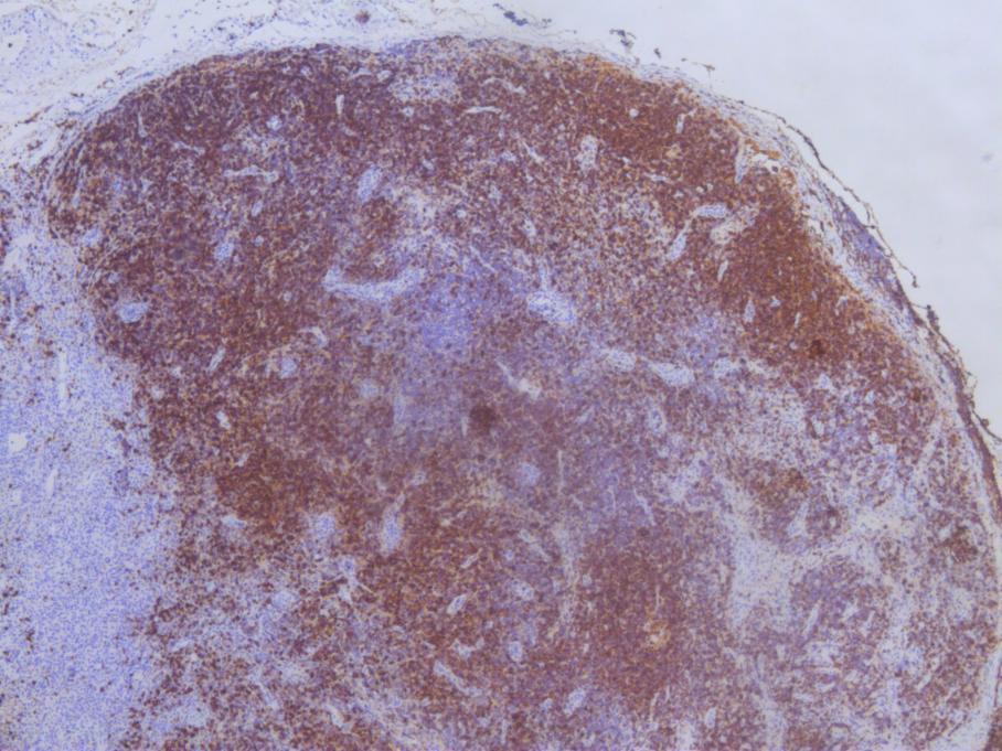 漳州正兴医院看儿童怎么样,漳州正兴医院儿科主治医生