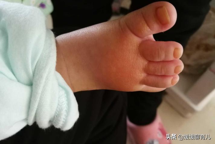 小孩子总是脱袜子是怎么回事,宝宝经常脱袜子怎么办