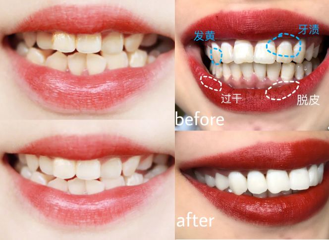 陈乔恩牙膏,陈乔恩推荐的化妆水是什么