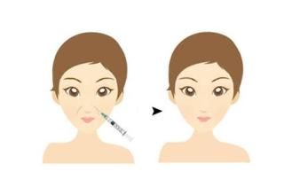 怎么能淡化法令纹的小妙招,法令纹显老不用愁一招改善法令纹