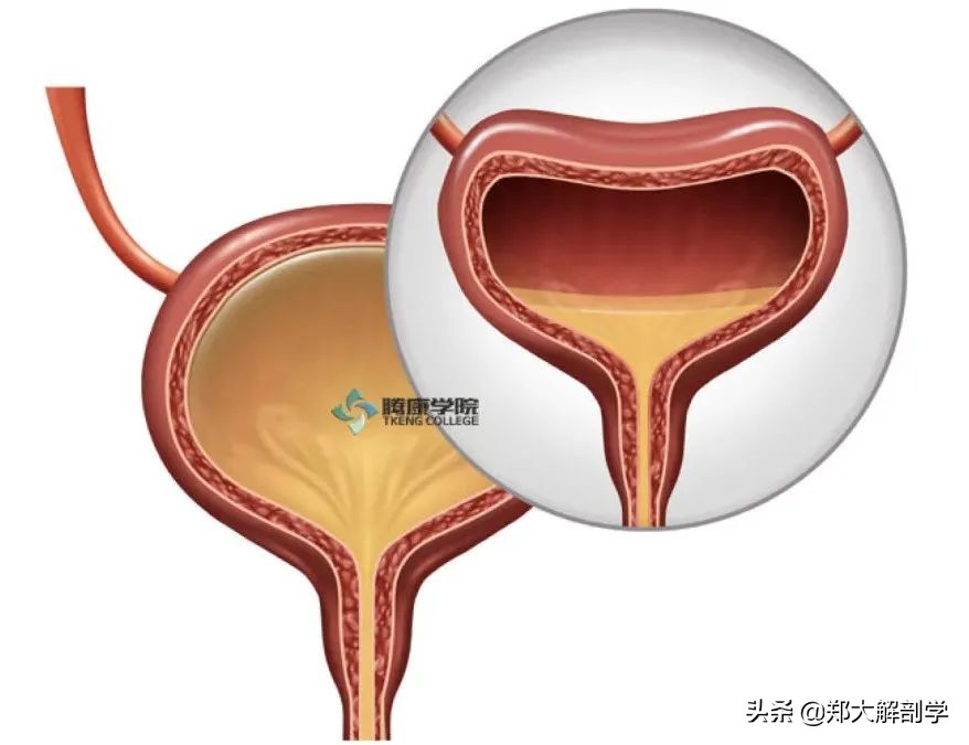 女性盆底功能障碍性疾病表现,盆底功能障碍会引起失眠吗