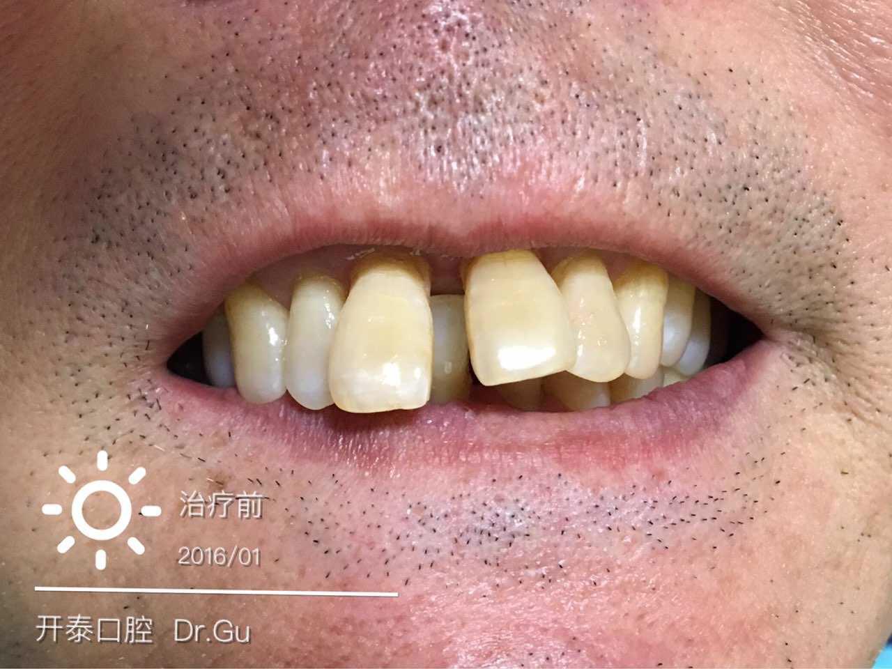 口腔医学医者仁心,口腔医学的工匠精神