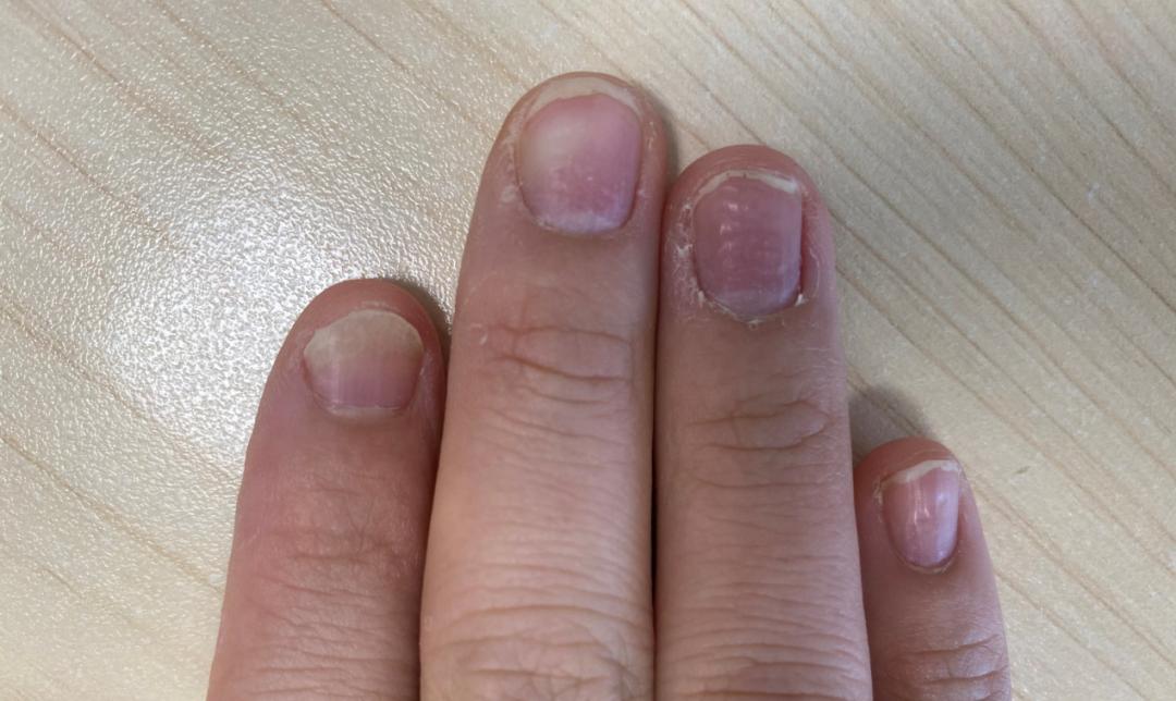 女人美甲到底该不该做,美甲指甲表面开裂是怎么回事