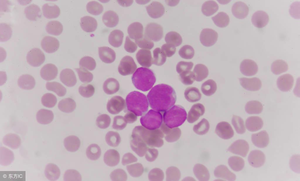 如果出现血小板减少如何用药调理,血小板减少可以输血补吗