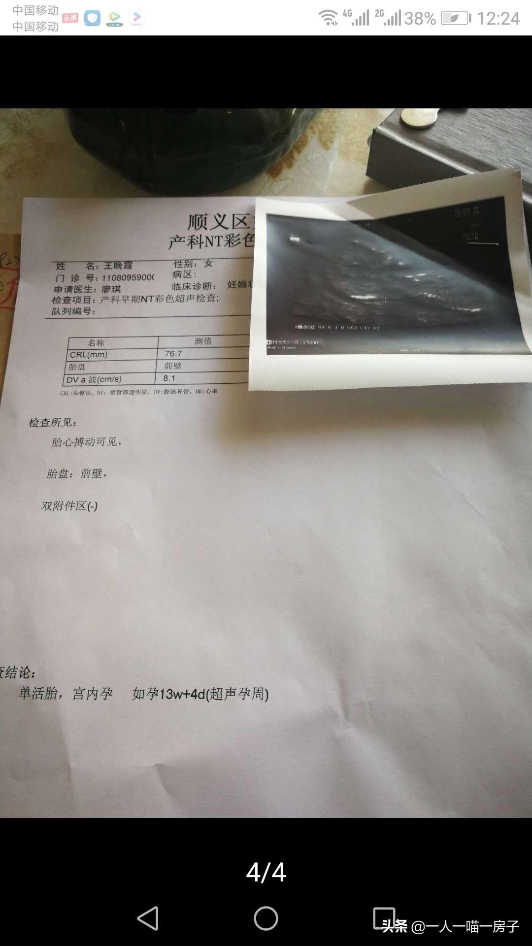 孕期日记:顺利通过无创DNA