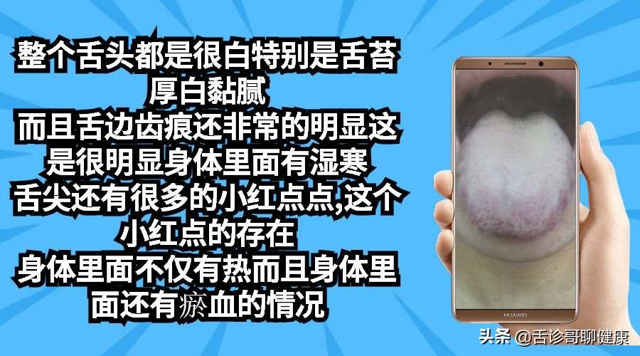 最实用舌诊图解专家总结六大舌象,零基础学舌诊气郁体质典型舌象