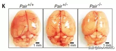 RNA疗法新策略：lncRNA功能元件制剂具备苯*酮丙**尿症治疗潜力