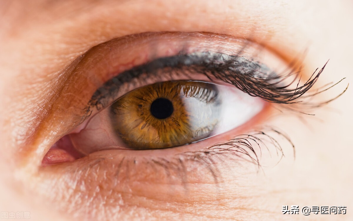 女子眼睛长石头,美女眼睛里长出结石
