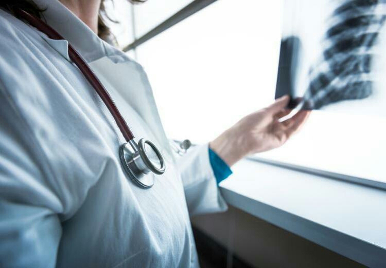 肺腺癌初期为啥很难被发现,肺腺癌肿瘤也可以很大吗